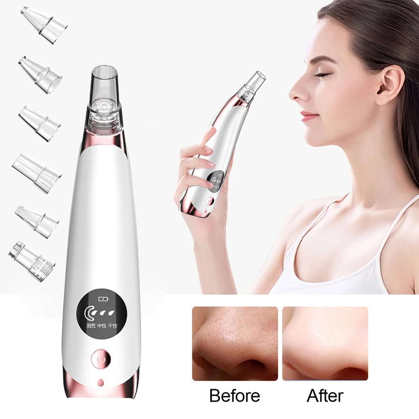 Banzch Electric Suction Blackhead Instrument Large Suction Blackhead Extractor Blackhead Facial Pore Cleaner Household With 6 Replace Suction Head,Mothers Day Gifts