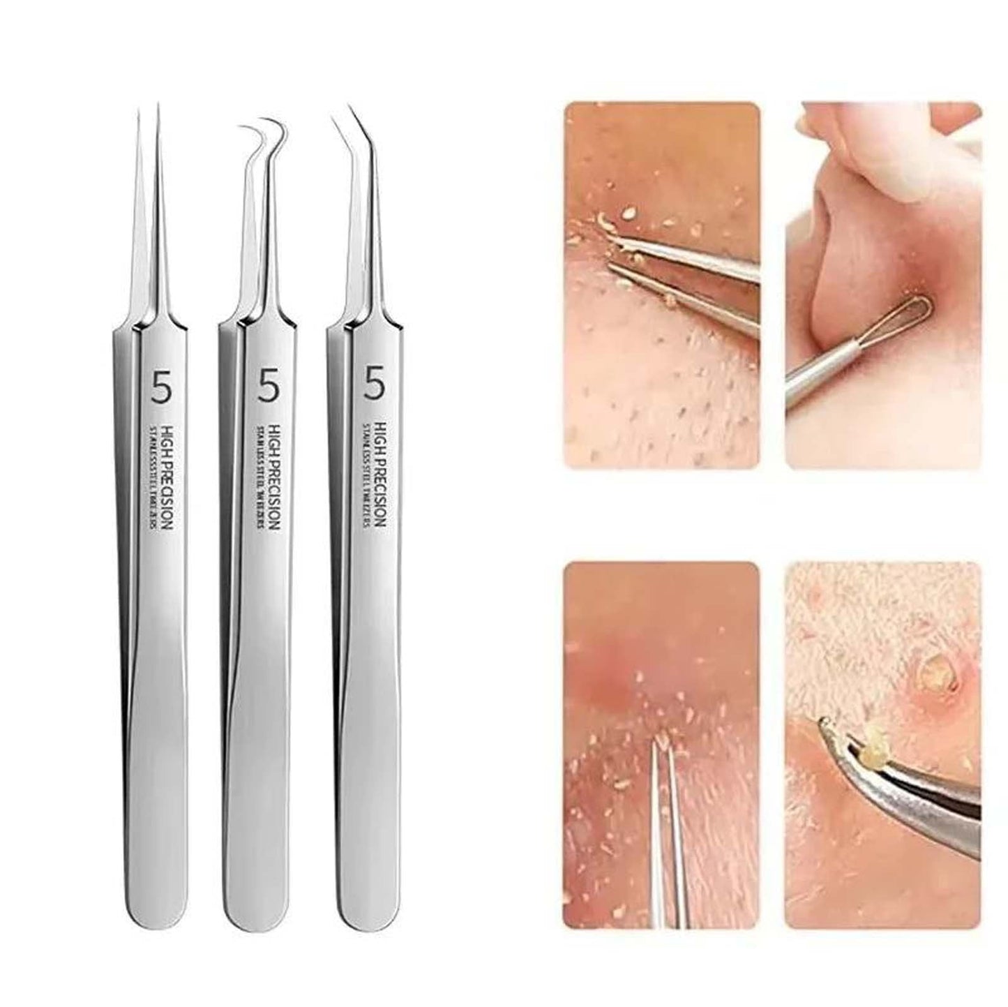 Banzch Facial Blackhead Remover Tweezers, Stainless Steel Clip Removal Set Beauty Tool Tweezers,Mothers Day Gifts