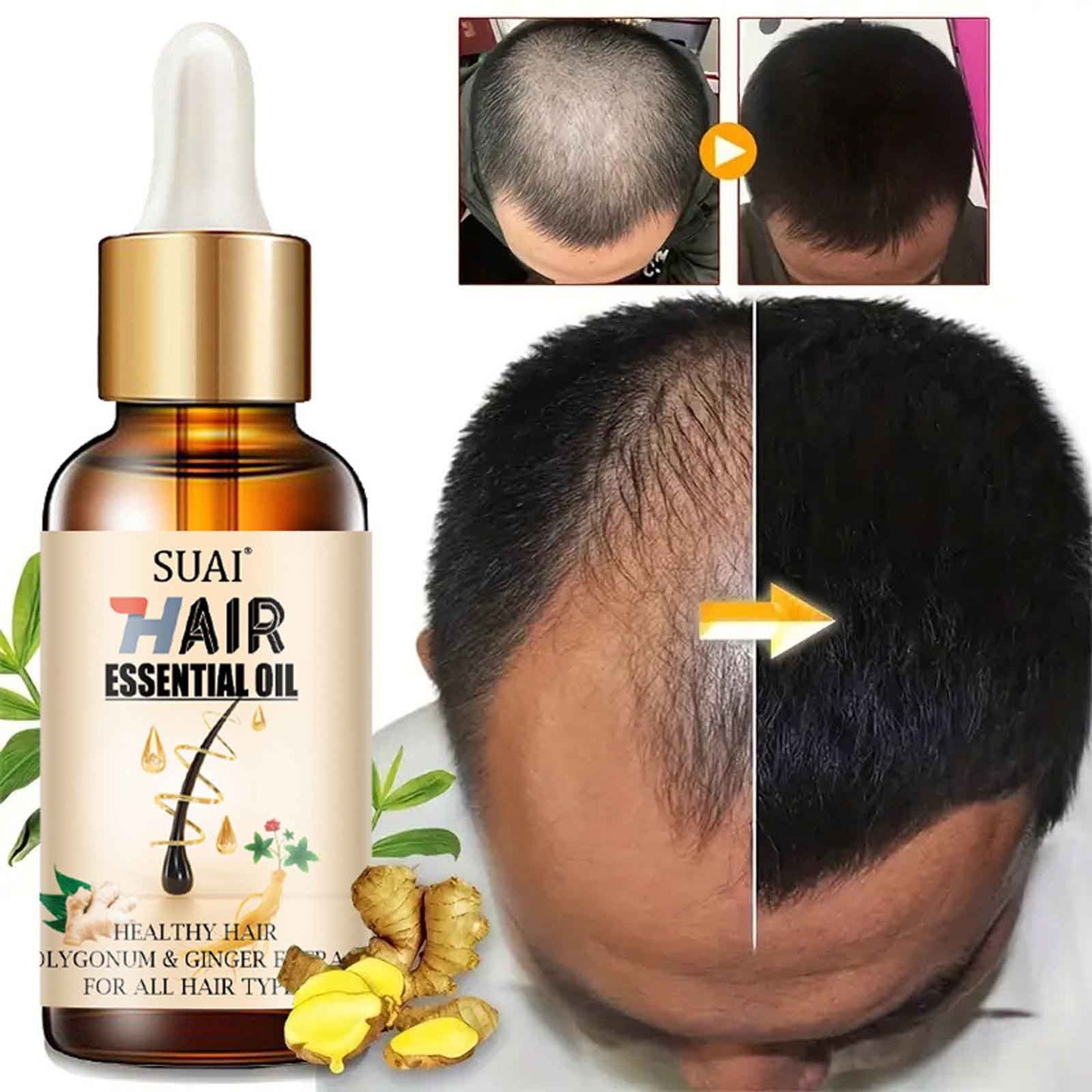 Banzch Hair Growth Essential Oil Hair Care To Repair Hair Frizz And Help Growth 20ml,Essential Oils,Mothers Day Gifts