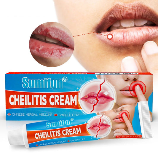 Banzch Dry Cracked Lips - Healing Lip Balm For Severely Chapped Lips - Designed For Men, Women And Children,Mothers Day Gifts