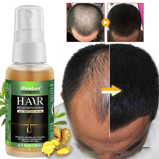Banzch Hair Growth Essential Oil Hair Care To Repair Hair Frizz And Help Growth 20ml,Essential Oils,Mothers Day Gifts