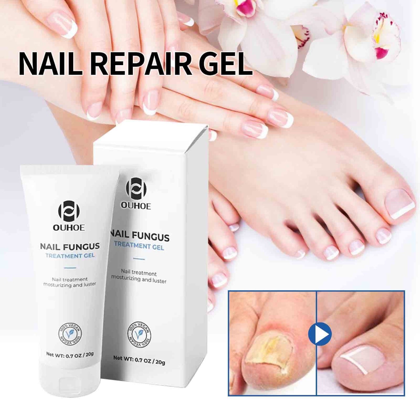 Banzch Nail Feet Care Gel Whitening Toe Nail Fungu Removal Repair Essence,Mothers Day Gifts