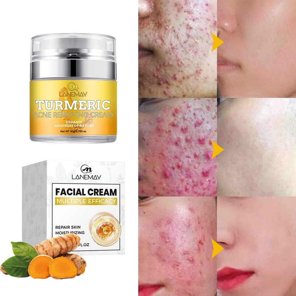 Banzch Turmeric Face Cream For Face & Body -Natural Turmeric Skin Brightening Lotion - Turmeric Cleanses Skin, Fights, Evens Tone, , Sun Damage,Mothers Day Gifts