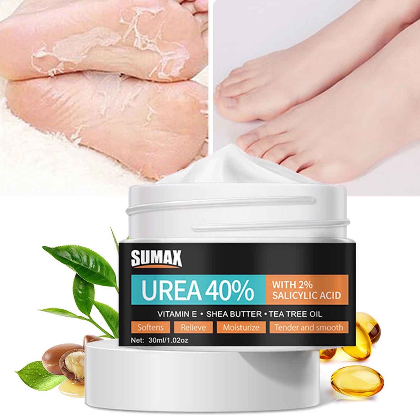 Banzch Urea Cream 40% | 2% Salicylicacid | Intensive Urea Foot Cream & Callus Remover | With Aloevera And Teatree Oil For Deep Moisturing And Skin Softening 30ml,Mothers Day Gifts