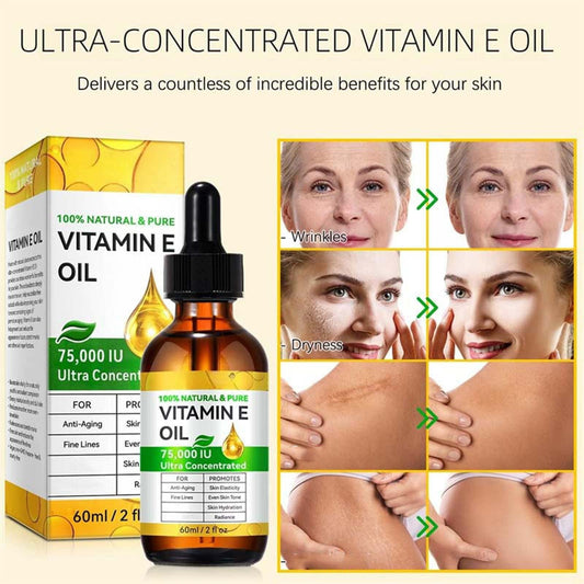 Banzch Vitamin E Oil, Vitamin E Oil for Skin, Face, Hair, Body, Natural Antioxidant for Dryness, Wrinkles, Scars & Stretch Marks, Moisturizing and Firming Skin