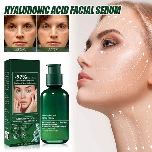 Banzch 2PCS Skin Firming Rejuvenating Serum Skin Firming Serum for Face and Neck Tightening Lotion Firming, Skin Firming£¬For All Skin Types (1pc)
