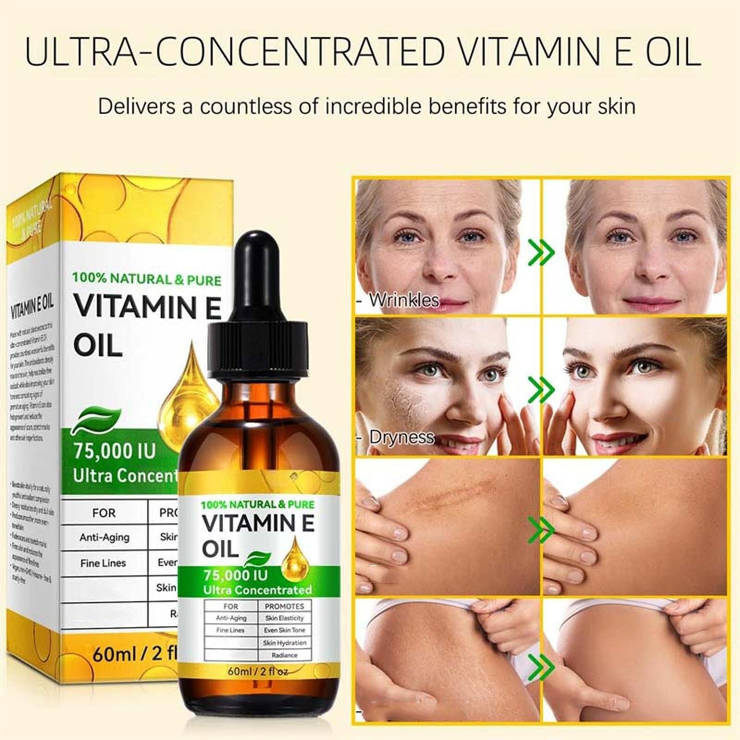 Banzch Vitamin E Oil, Vitamin E Oil for Skin, Face, Hair, Body, Natural Antioxidant for Dryness, Wrinkles, Scars & Stretch Marks, Moisturizing and Firming Skin