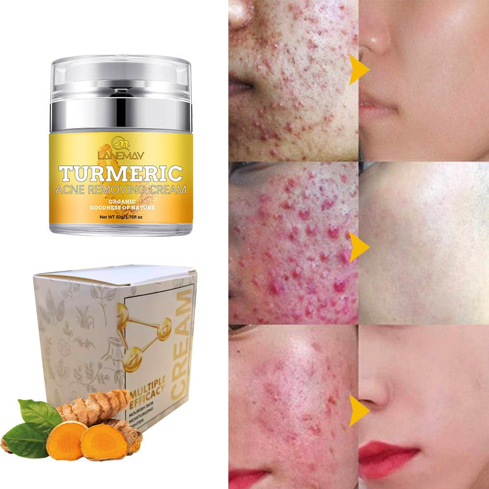 Banzch Turmeric Face Cream For Face & Body -Natural Turmeric Skin Brightening Lotion - Turmeric Cleanses Skin, Fights, Evens Tone, , Sun Damage,Mothers Day Gifts