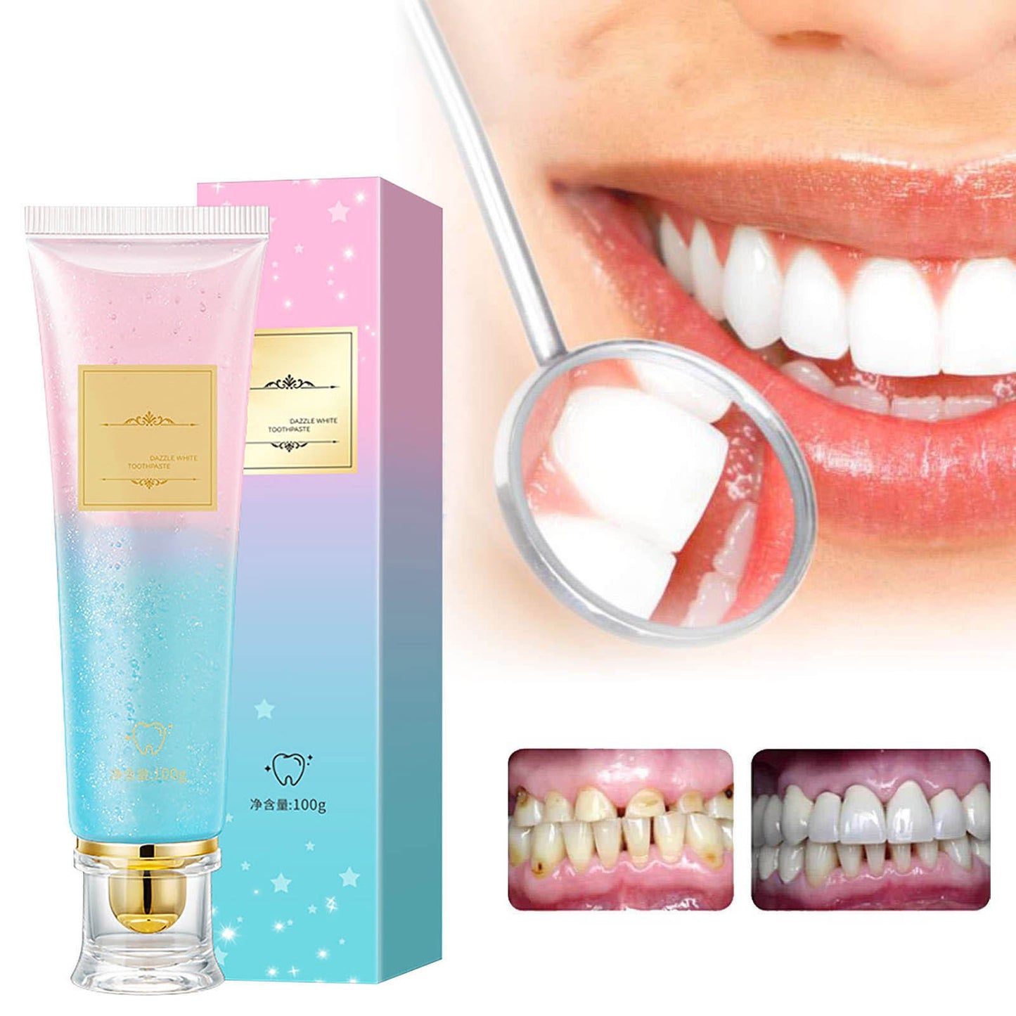 Banzch Niacinamide Toothpaste, Brightening Toothpaste with Brightening Formula, Deep Cleaning Oral Care for Fresh Breath, Removes Stains and Protects Teeth