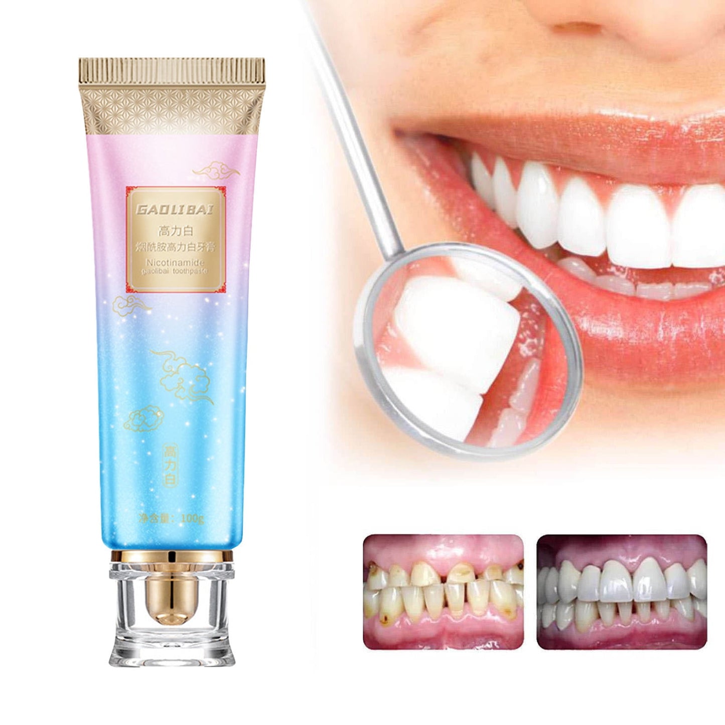 Banzch Niacinamide Whitening Toothpaste, Nicotinamide Whitening Toothpaste Cleaning Fresh Breath,Fresh Breath Toothpaste, Remove Tooth Stains£¬1PCS